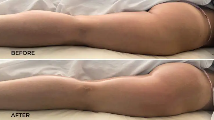 Lymphatic Drainage Massage ITEC