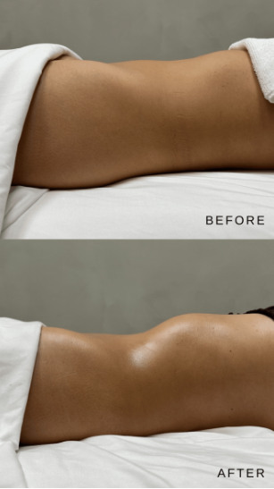 ITEC-  Lymphatic Drainage Massage