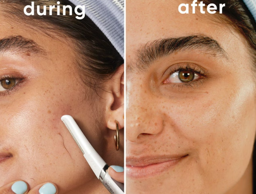 Advanced Skin Therapies  Level 4