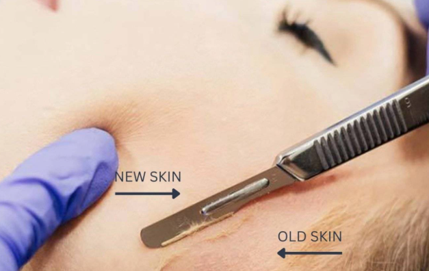 Beginners to Advanced Aesthetics  -  Level 3 & 4