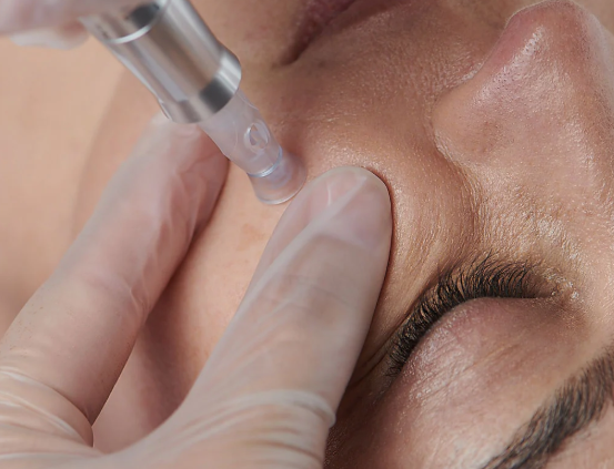 Beginners to Advanced Aesthetics  -  Level 3 & 4